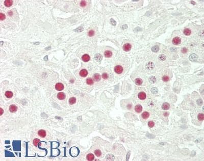 IHC-plus™ LIG3 / DNA Ligase III Antibody