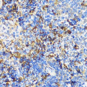 Polyclonal Rabbit anti-Human NAMPT / Visfatin Antibody (IHC, IF, WB)