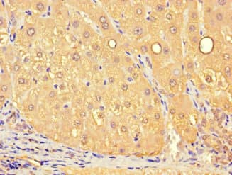 SLC25A10 / DIC Antibody