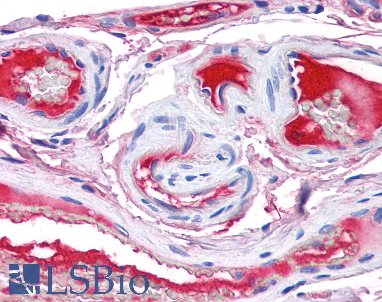 IHC-plus™ F12 / Factor XII Antibody