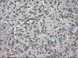 Monoclonal Mouse anti-Human BUB1B / BubR1 Antibody (clone OTI10B7, IHC, IF, WB)