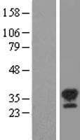STK16 Protein (Over-Expression Lysate Myc-DDK (Flag))
