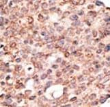Polyclonal Rabbit anti-Human CRY2 Antibody (aa564-593, IHC, WB)