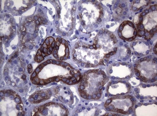 SYNC / SYNCOILIN Antibody (clone OTI5B8)