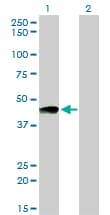 Monoclonal Mouse anti-Human PTGIR / IP Receptor Antibody (clone 4B10, WB)