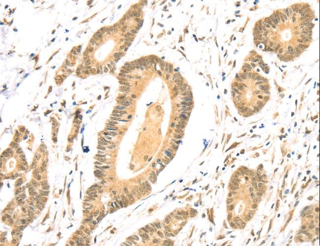 TSPAN13 / TM4SF13 Antibody
