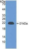 MUC5AC Antibody (aa2662-2755)