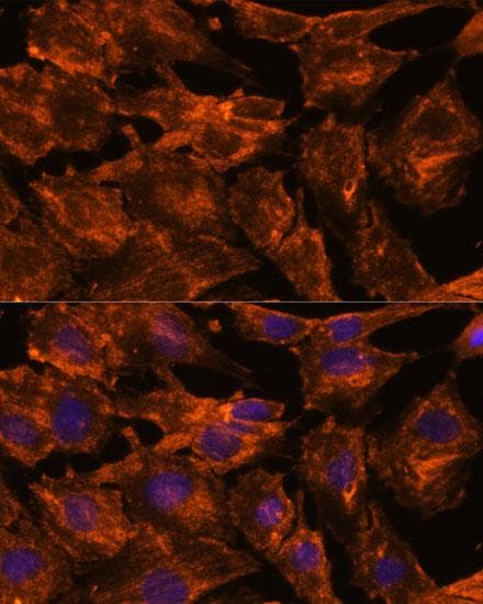 Polyclonal Rabbit anti-Human ITSN2 Antibody (IF, WB)