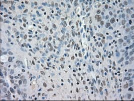 BUB1B / BubR1 Antibody (clone OTI11G2)