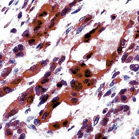 Polyclonal Rabbit anti-Mouse KDR / VEGFR2 / FLK1 Antibody (C-Terminus, IHC, WB)