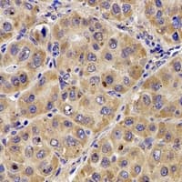 Complement C7 Antibody (N-Terminus)