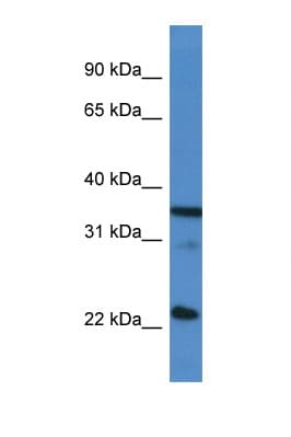 Polyclonal Rabbit anti-Human SRSF2 / SC35 Antibody (C-Terminus, IHC, WB)