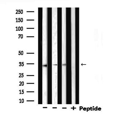 STARD10 Antibody