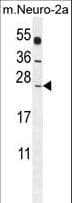 Polyclonal Rabbit anti-Human POLR2J Antibody (aa86-115, IHC, WB)