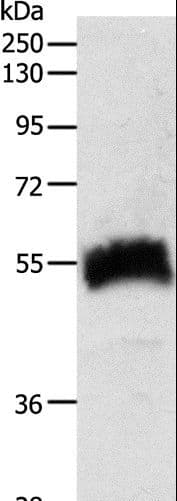 Polyclonal Rabbit anti-Human SLC22A6 / OAT1 Antibody (IHC, WB)