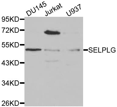 Polyclonal Rabbit anti-Human SELPLG / PSGL-1 / CD162 Antibody (IHC, IF, WB)
