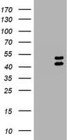 LHX1 Antibody (aa100-362, clone OTI1D5)