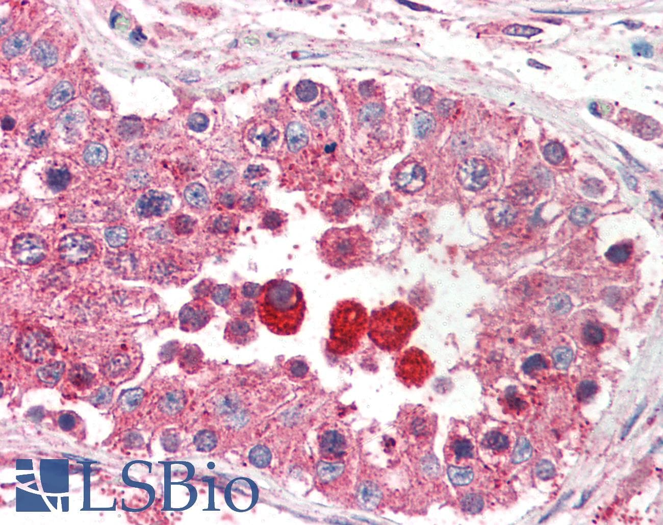 IHC-plus™ Polyclonal Goat anti-Human EIF3M / PCID1 Antibody (aa355-366, IHC, WB)