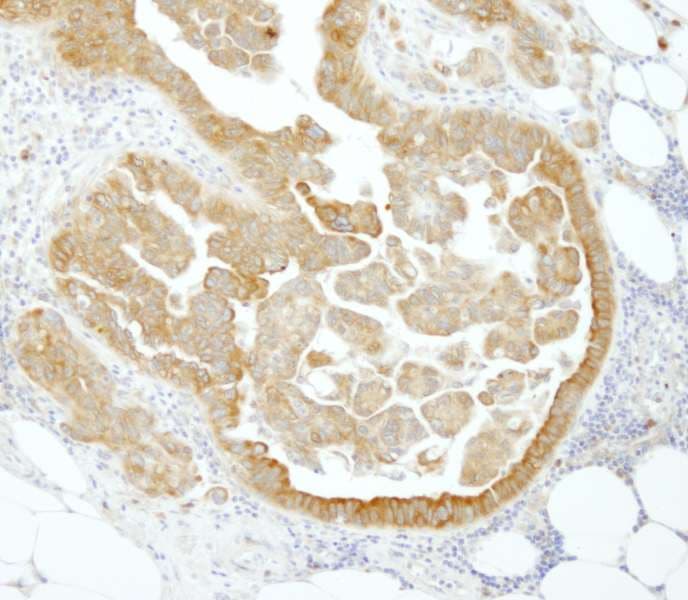 PABPC4 Antibody (aa525-575)