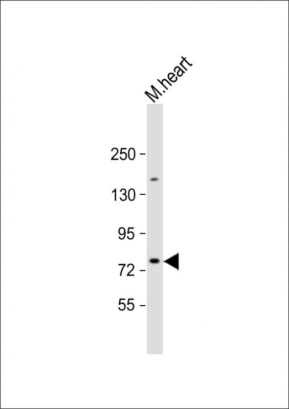 SLC6A8 Antibody (N-Terminus)