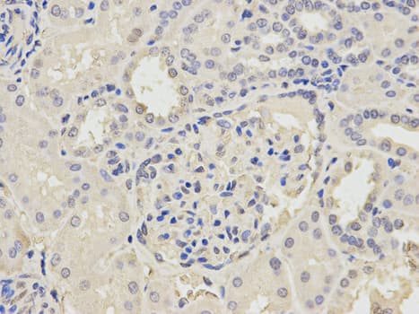 POLH / DNA Polymerase Eta Antibody