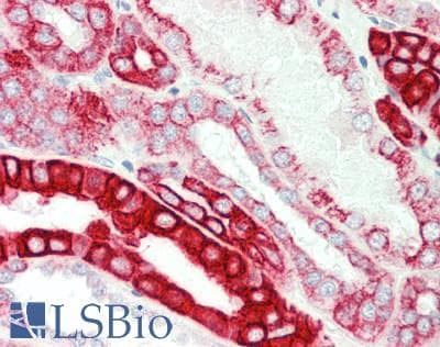CRAT Antibody (aa22-71)