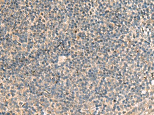 Polyclonal Rabbit anti-Human POFUT1 Antibody (IHC)