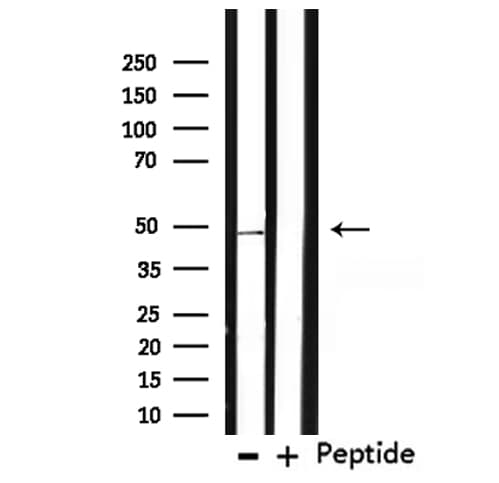 TMPRSS3 Antibody
