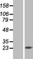 RGS10 Protein (Over-Expression Lysate Myc-DDK (Flag))