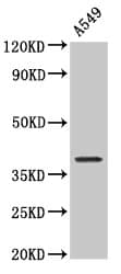 NDRG4 Antibody