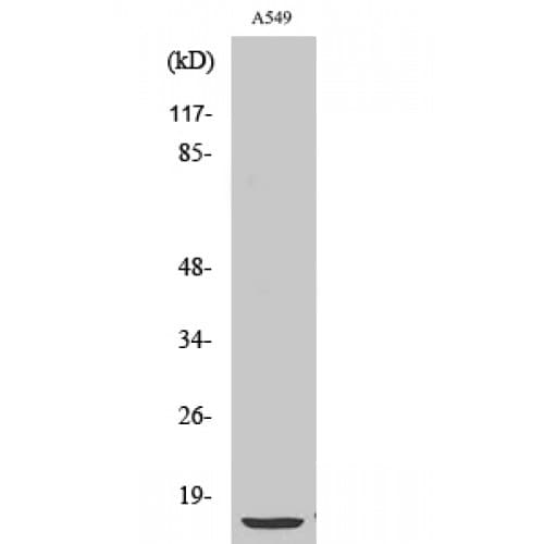 PTH / Parathyroid Hormone Antibody (30-110 aa, Internal)