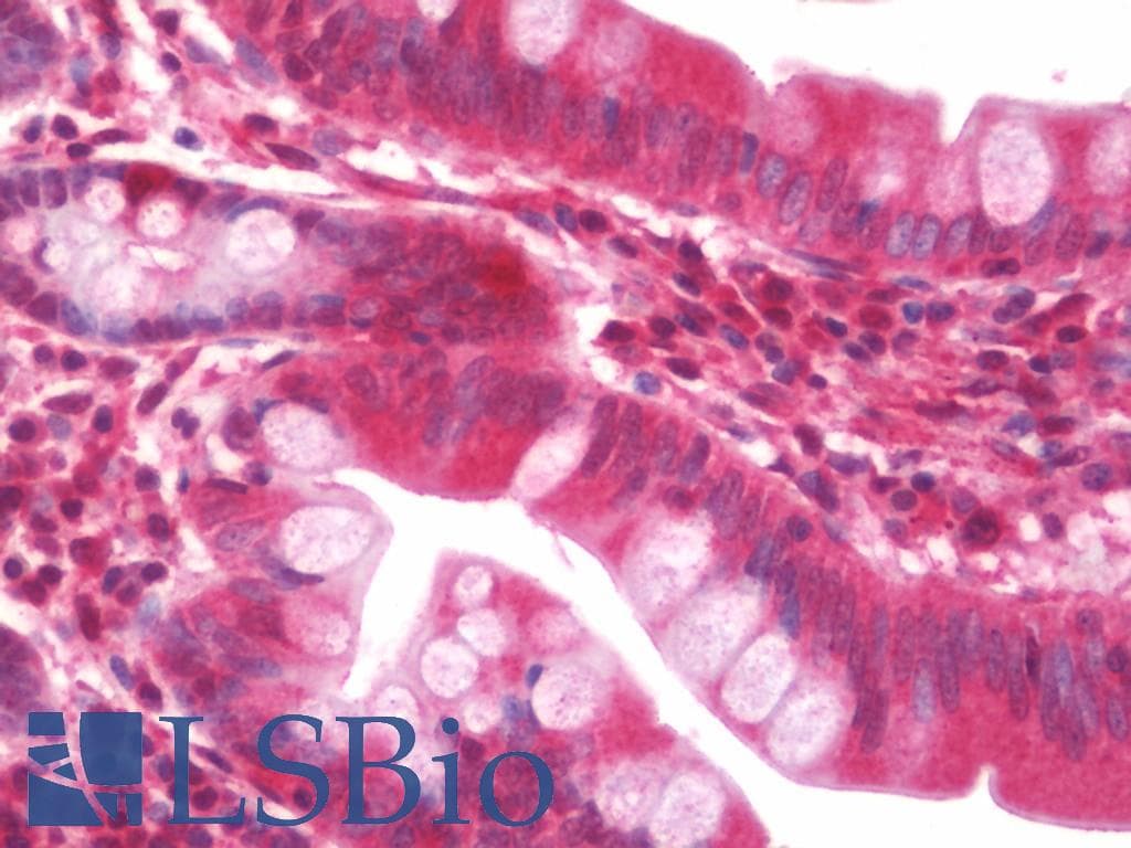 IHC-plus™ Polyclonal Rabbit anti-Human RPS16 / Ribosomal Protein S16 Antibody (IHC, WB)