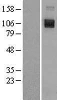 SEMA4D / Semaphorin 4D / CD100 Protein (Over-Expression Lysate Myc-DDK (Flag))