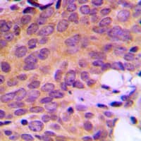 ATXN2 / SCA2 / Ataxin-2 Antibody (Internal)