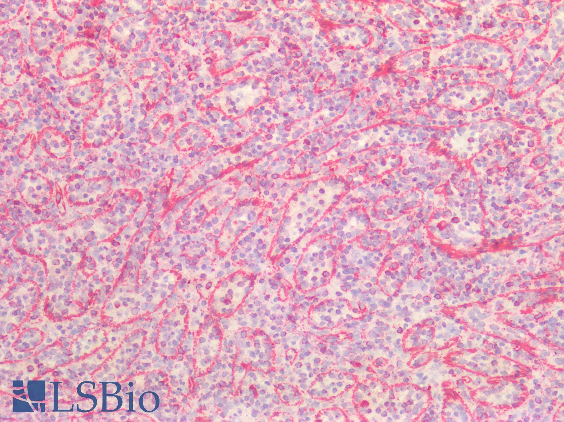 PathPlus™ Vimentin Antibody