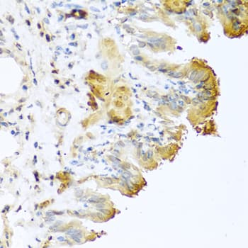 VTN / Vitronectin Antibody
