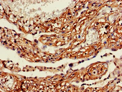 ACS5 / ACSL5 Antibody