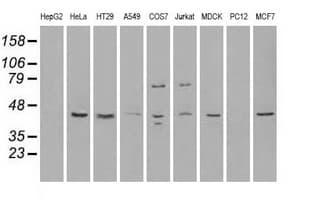 RAD9A / RAD9 Antibody (clone OTI5D9)