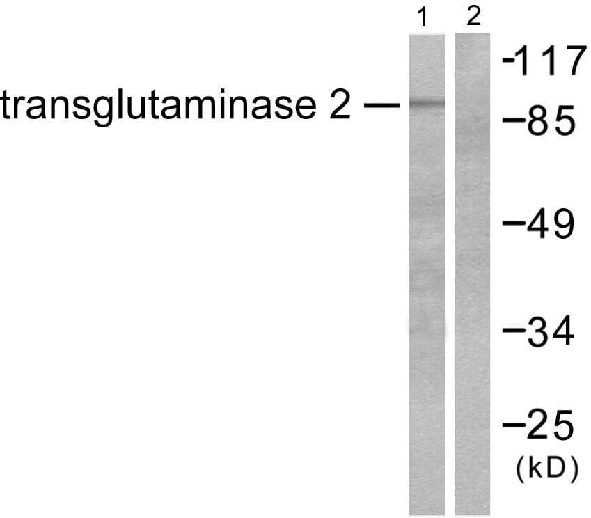 TGM2 / Transglutaminase 2 Antibody