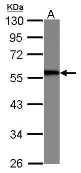Polyclonal Rabbit anti-Human PAI-RBP1 / SERBP1 Antibody (WB)