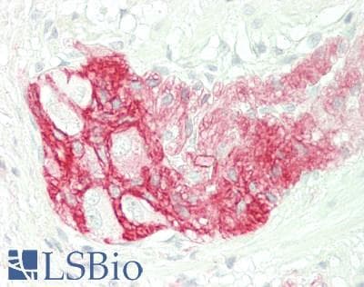PathPlus™ NGFR / CD271 / TNR16 Antibody