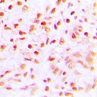 SENP6 Antibody (C-Terminus)