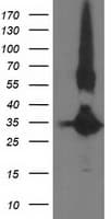 MGLL / Monoacylglycerol Lipase Antibody (clone OTI4D1)