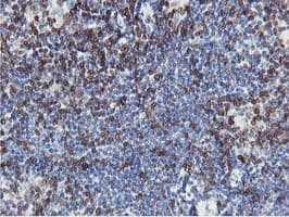 APMAP / C20orf3 Antibody (clone OTI1D7)