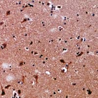 Polyclonal Rabbit anti-Human GFPT1 / GFAT Antibody (IHC, WB)