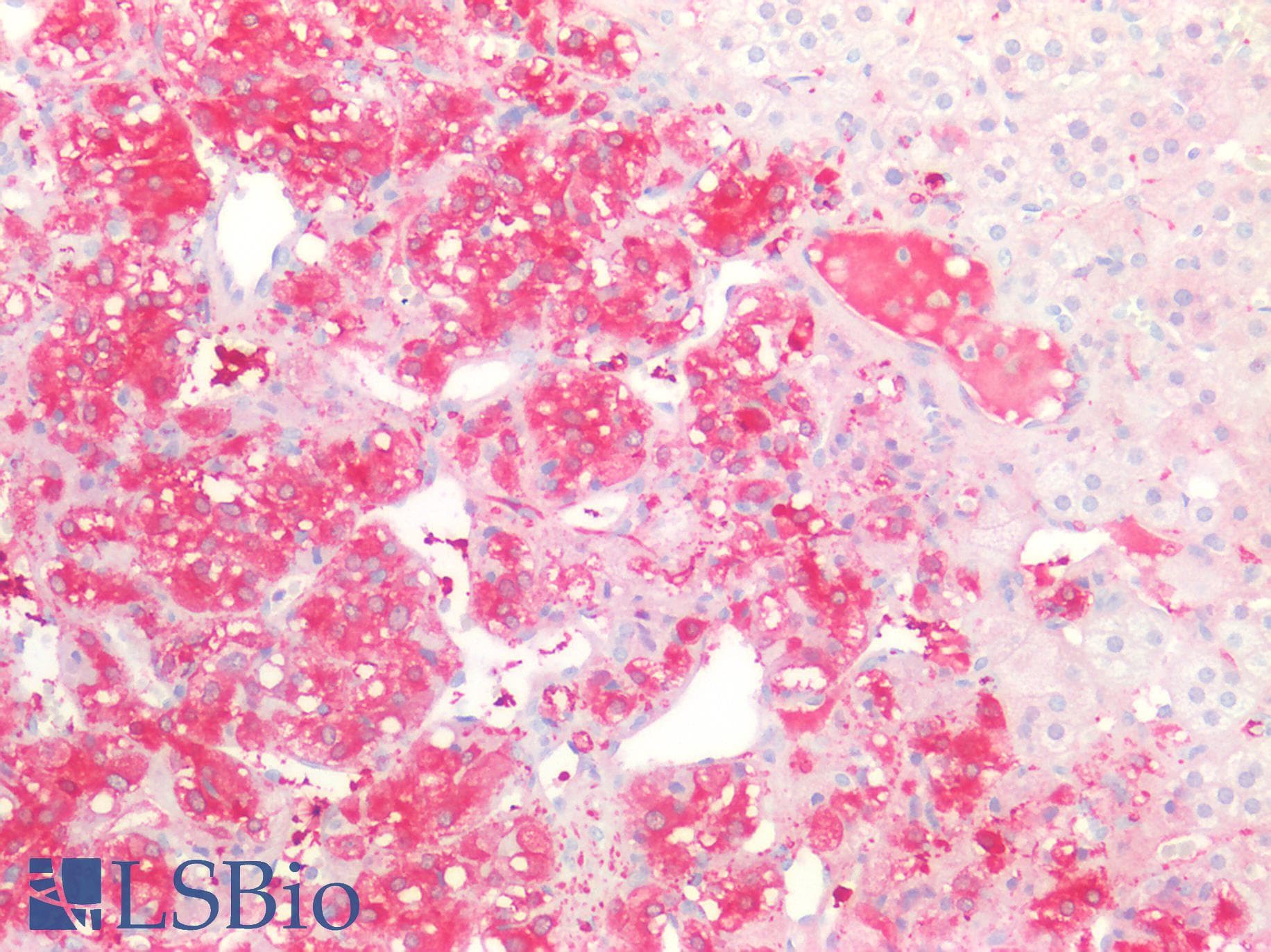 PathPlus™ Polyclonal Rabbit anti-Human ENO2 / NSE Antibody (IHC, WB)