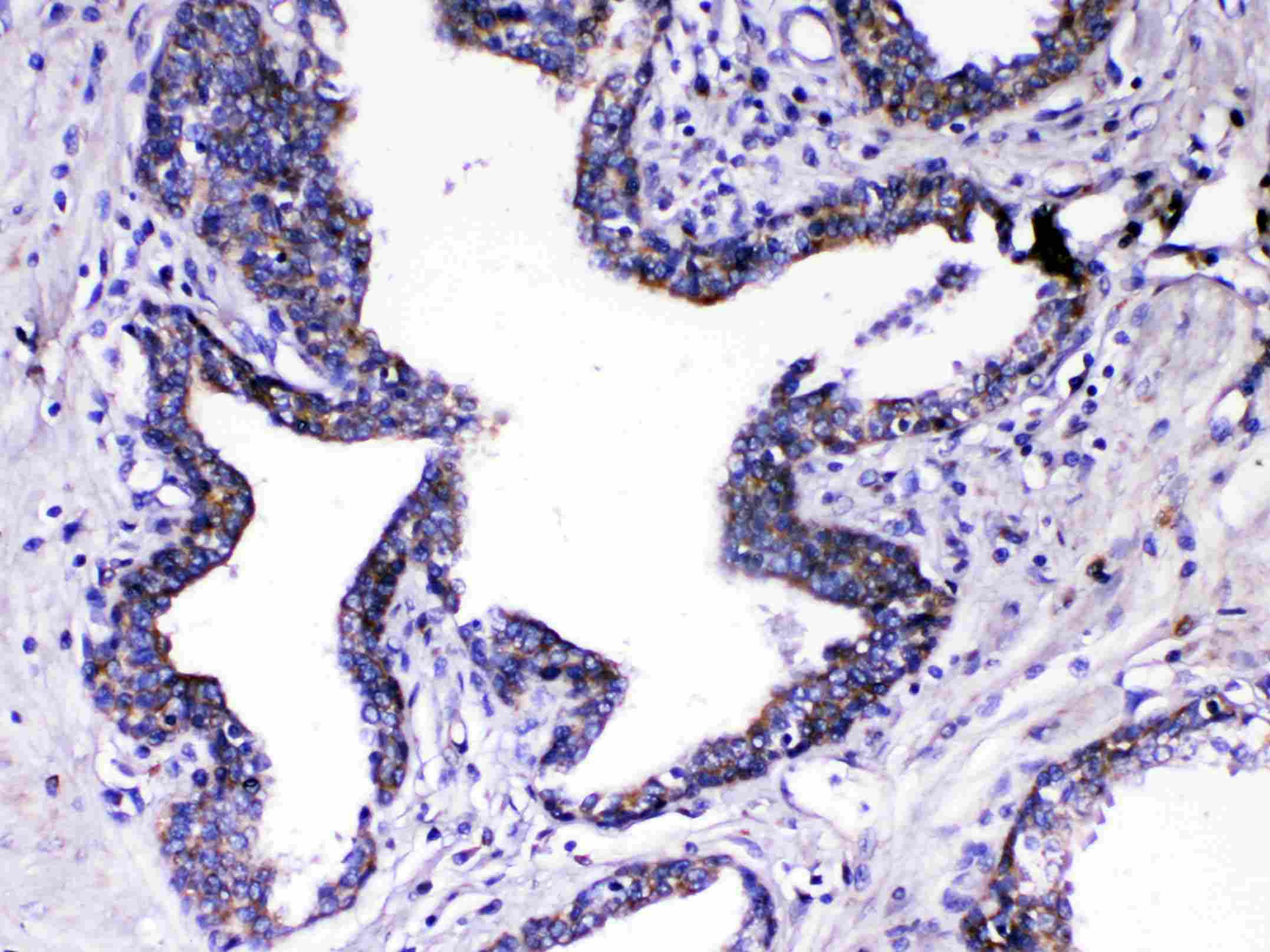 Polyclonal Rabbit anti-Human RLN1 / Relaxin Antibody (IHC, WB)