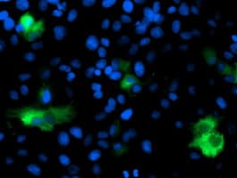 IHC-plus™ DPP9 Antibody (clone 4H8)