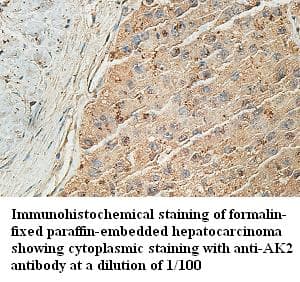 AK2 / Adenylate Kinase 2 Antibody