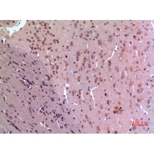 GDI2 Antibody (C-terminal)